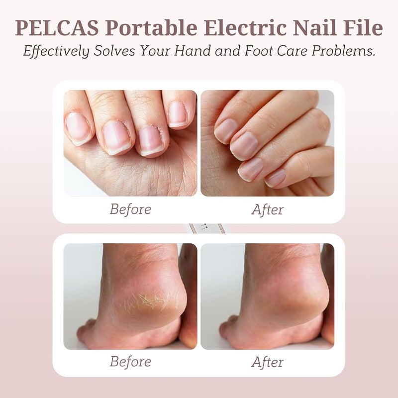 PELCAS Electric Nail File, 5 Speeds Nail Grinder for Thick Toenails, Cordless Nail Drill, Manicure and Pedicure Kit with LED Light, Toenail Grinder for Human, Thick Toenails, Natural & Acrylic Nails - Image 2